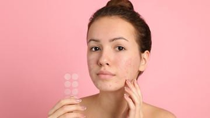 5 Rekomendasi Acne Patch Terbaik untuk Tutupi Hingga Redakan Masalah