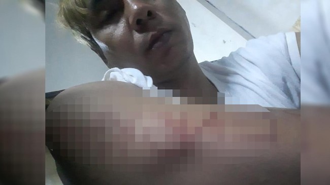 Pengacara Ryan Jombang membenarkan luka sayat bertulis 'pengkhianat' di lengan kliennya, dilakukan oleh Bahar bin Smith.