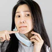 Skindemik: Masalah Kulit Kering Hingga Berjerawat Selama Pandemi, Ini Solusinya!