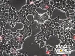 Ngeri, Rekaman Virus Corona Ngamuk Serang Sel Otak