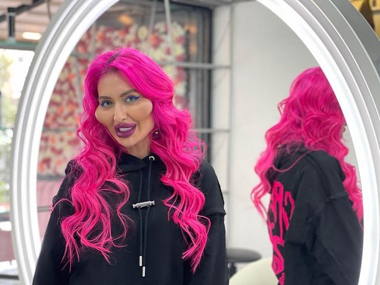 Penampakan Wajah Model Ukraina Setelah Perawatan Rp300 Juta Wajah Anatasiia Pokreshcuk berubah menjadi monster setelah habiskan Rp300 juta untuk perawatan. Yuk intip penampakan wajahnya!