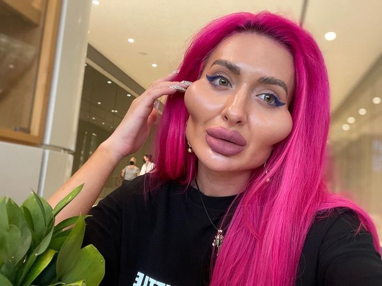 Penampakan Wajah Model Ukraina Setelah Perawatan Rp300 Juta Wajah Anatasiia Pokreshcuk berubah menjadi monster setelah habiskan Rp300 juta untuk perawatan. Yuk intip penampakan wajahnya!
