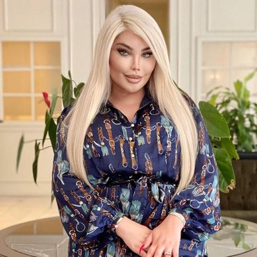 Disengat Lebah, Implan Bokong Transgender 'Barbie' Meledak