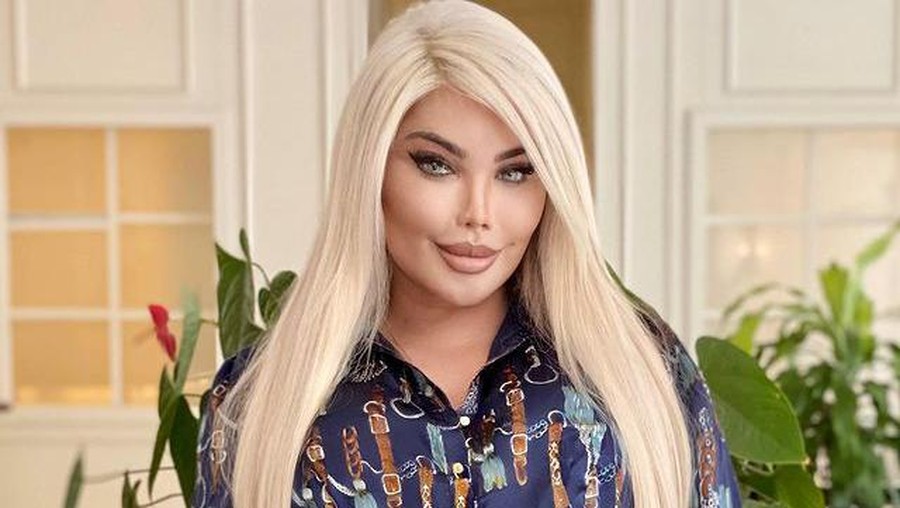 Seorang transgender asal Brazil, Jessica Alves menceritakan kesakitannya saat hilang keperawanan. Yuk intip potretnya!