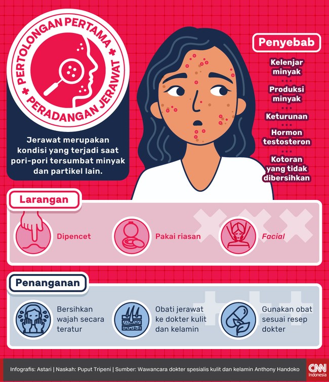 Jerawat merupakan penyakit kulit yang mesti mendapat pengobatan. Berikut pertolongan pertama pada jerawat.