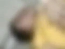 Wanita Grobogan yang Viral Ngaku Diinjak-injak Oknum Kades Opname di RS