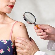 7 Masalah Kulit Paling Umum yang Sebaiknya Tidak Diagnosa Sendiri, Bahaya!