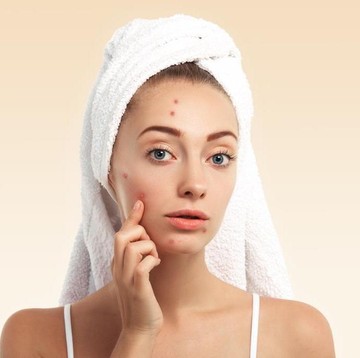 img-title Hempas Jerawat Membandel Dengan 5 Skincare Korea Ini, Auto Glowing!