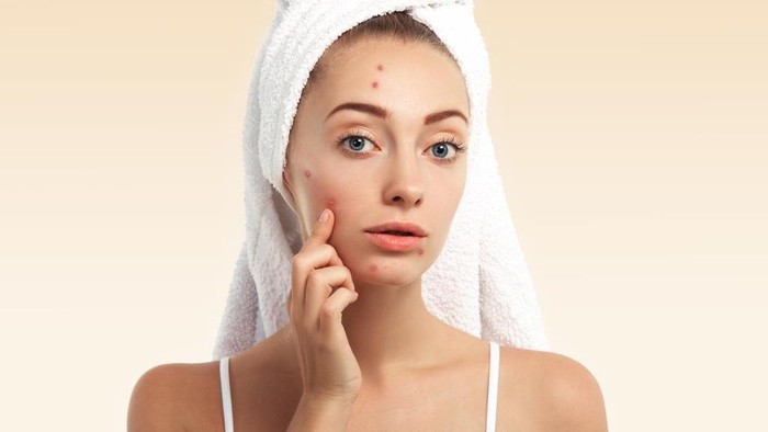 Hempas Jerawat Membandel Dengan 5 Skincare Korea Ini, Auto Glowing! Hempas Jerawat Membandel Dengan 5 Skincare Korea Ini, Auto Glowing!