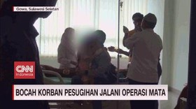 VIDEO: Bocah Korban Pesugihan Jalani Operasi Mata