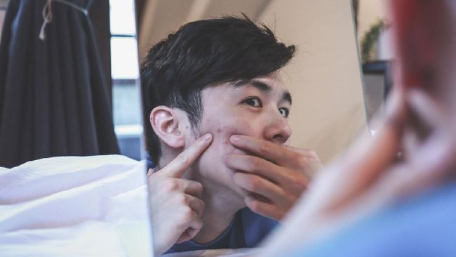 Setelah jerawat kempis, bekasnya yang kehitaman perlu dihilangkan. Berikut bahan skincare pria untuk menghilangkan bekas jerawat.