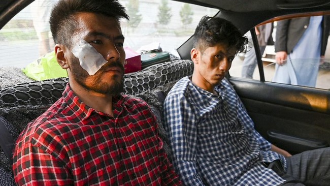 Dua jurnalis Afghanistan babak belur akibat dipukuli Taliban setelah ditangkap saat sedang meliput aksi demonstrasi di Kabul pada Rabu (8/9) lalu.