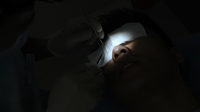 Polda Metro Jaya menyelidiki dugaan malapraktik operasi hidung di Cakung. Tiga korban melapor akibat hasil operasi membuat hidung miring hingga keluar nanah.