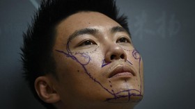 FOTO: Pria Muda China dan Tren Operasi Plastik