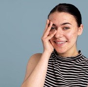 Penelitian Terbaru, Kulit Sensitif Memiliki Kandungan Microbiome yang Rendah, Begini Penjelasannya!