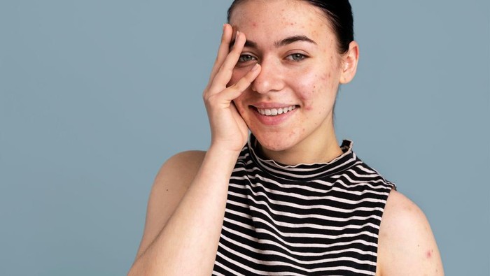 Penelitian Terbaru, Kulit Sensitif Memiliki Kandungan Microbiome yang Rendah, Begini Penjelasannya! Penelitian Terbaru, Kulit Sensitif Memiliki Kandungan Microbiome yang Rendah, Begini Penjelasannya!