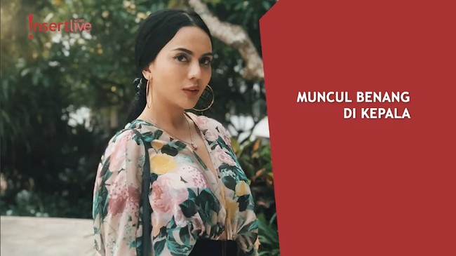 Merasa Jadi Korban Malpraktik Klinik Kecantikan, Anggita Sari Ogah Lapor Polisi