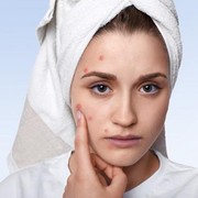 5 Tanda Ini Buktikan Kamu Alergi Kosmetik, Jangan Beli Produk Sembarangan Lagi Ya!