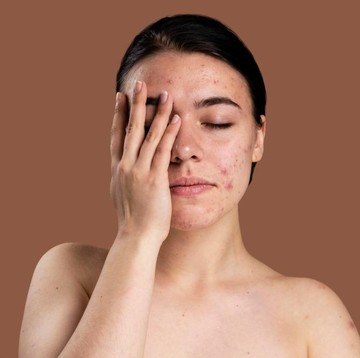 img-title Jangan Lagi Dipakai, Inilah 5 Tanda Produk Skincare Tidak Cocok untuk Kulit Wajahmu!