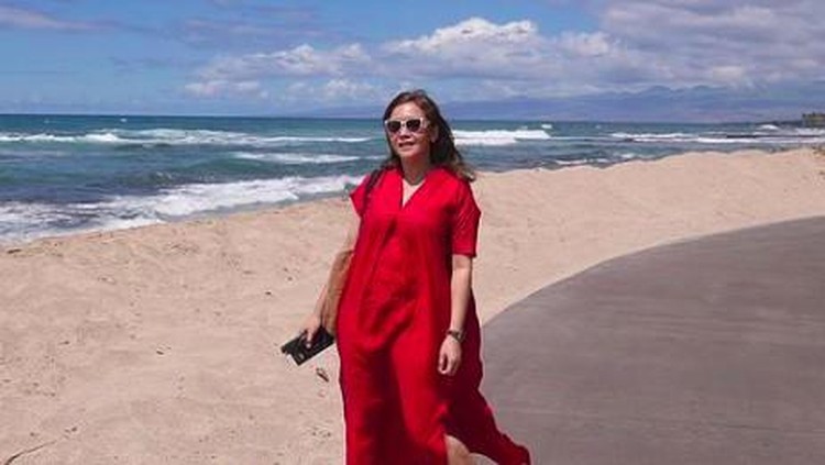 Maia Estianty idap penyakit kulit