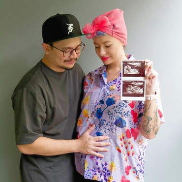 Selamat, Istri Derby Romero Hamil Anak Pertama