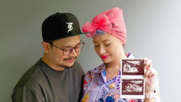 Selamat, Istri Derby Romero Hamil Anak Pertama