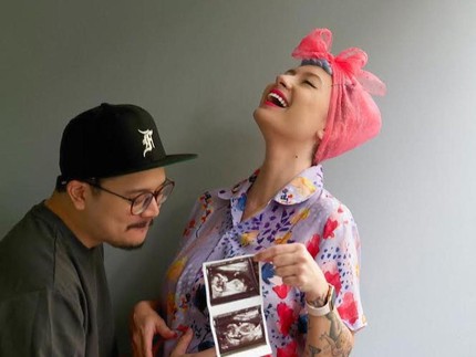 Claudia Adinda & Derby Romero Menjawab Kenapa Tunda Hamil Selama 4 Tahun