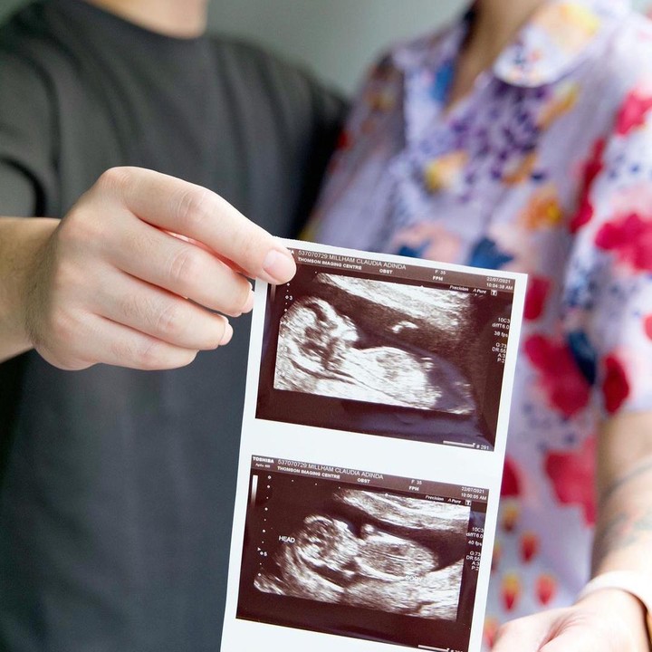 <p>"<em>So happy to finally announce that we are going to be parents!!! This was the best birthday surprise for me from @miss_adinda_mae back in June!!! Gw bakal jadi papa!!!!"</em> tulis Derby Romero di caption Instagram-nya. (Foto: Instagram @derbyromero)</p>
