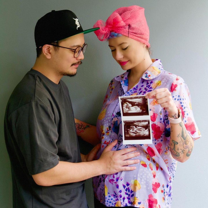 <p>Di foto, terlihat aktor pemeran Sadam di <em>Petualangan Sherina</em> itu dan istri begitu bahagia. Mereka sampai menunjukkan hasil USG-nya, Bunda. (Foto: Instagram @derbyromero)</p>
