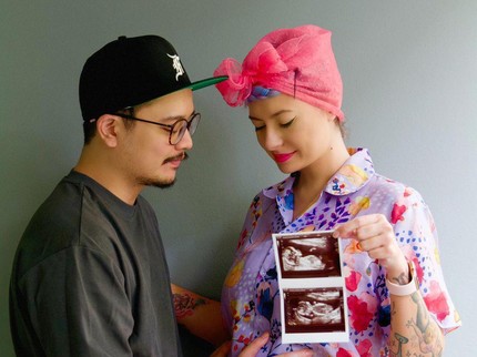 7 Potret Derby Romero dan Istri Umumkan Kehamilan Setelah Menanti 4 Tahun