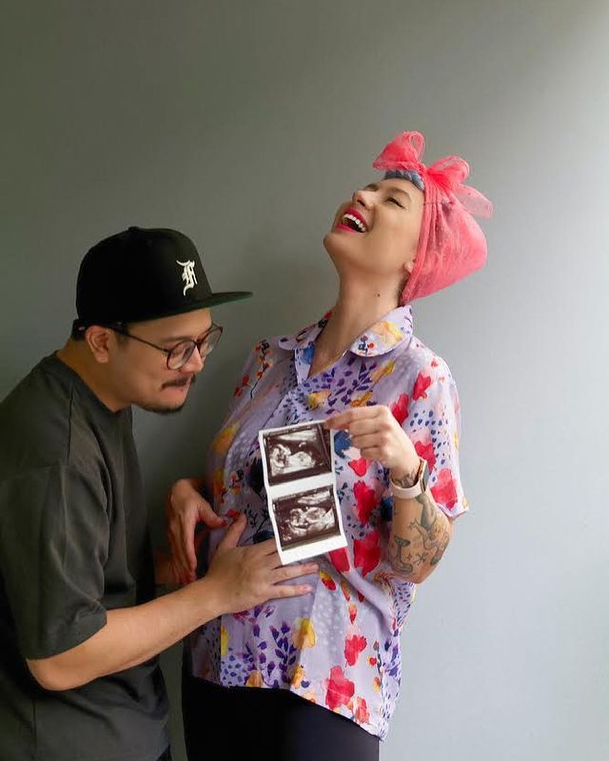 Gaya Nyentrik Claudia Adinda Istri Derby Romero yang Kini Hamil Anak Pertama