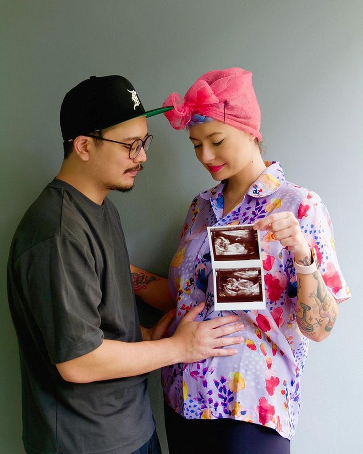 Gaya Nyentrik Claudia Adinda Istri Derby Romero yang Kini Hamil Anak Pertama