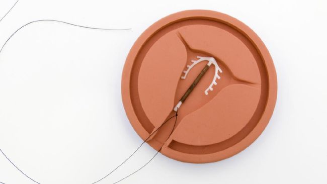 Hari Kontrasepsi Sedunia (World Contraception Day) diperingati tiap 26 September 2021. Tahun ini Hari Kontrasepsi menyoroti dampak Covid-19.