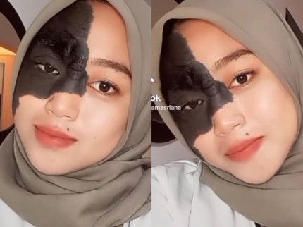 Gadis Mamuju Viral di TikTok, Jadi Korban Bully Gara-gara Tanda Lahir di Wajah