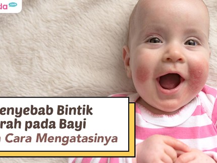 4 Penyebab Bintik Merah pada Bayi dan Cara Mengatasinya