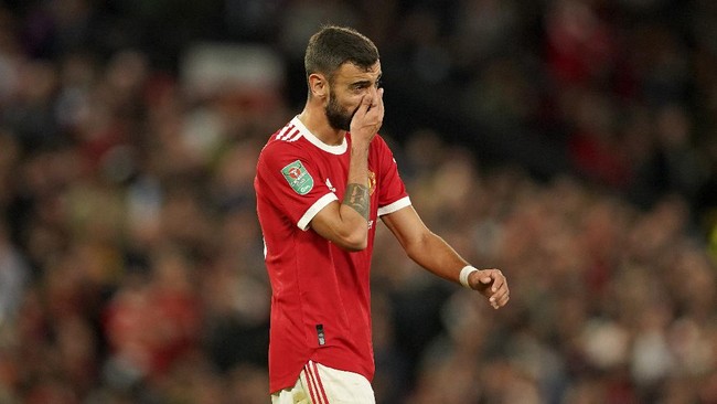 Bintang Manchester United Bruno Fernandes dicemooh suporter lawan setelah bertingkah konyol saat melawan West Ham United di Piala Liga Inggris.