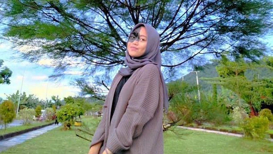 Viral Dibully Karena Tanda Lahir