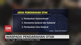 VIDEO: Tukul Arwana Pendarahan Otak, Waspada Pendarahan Otak