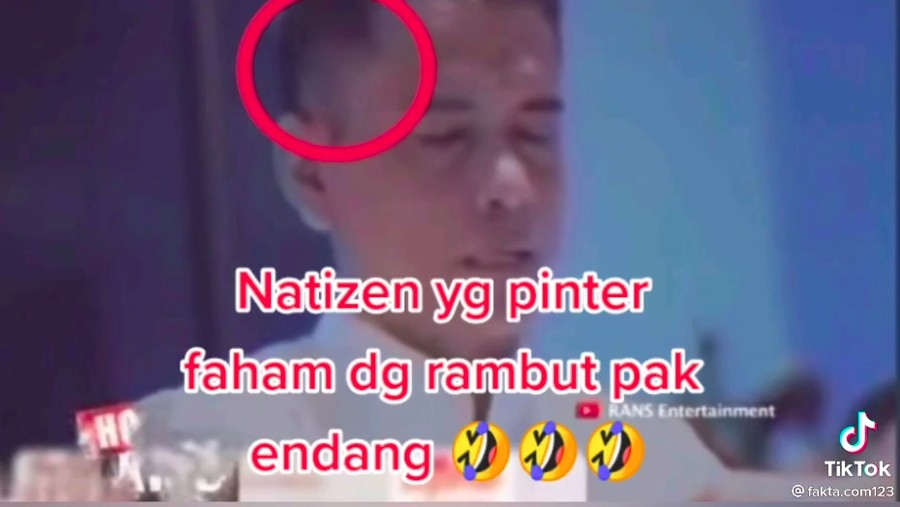 Viral rambut ayah Lesti Kejora