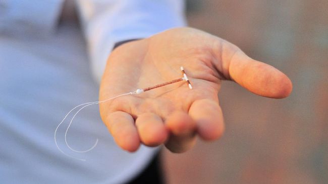Studi terbaru menemukan, pengguna kontrasepsi hormonal seperti IUD memiliki risiko kanker payudara yang lebih tinggi dibanding pengguna kontrasepsi lainnya.