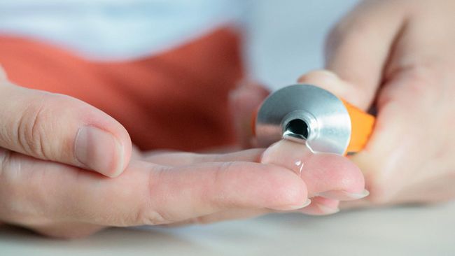 Pria bakal punya opsi lain kontrasepsi selain kondom dan vasektomi. Sebuah uji klinis memperlihatkan efektivitas dari alat kontrasepsi pria berbentuk gel.