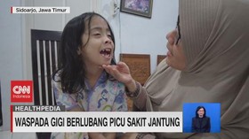 VIDEO: Waspada Gigi Berlubang Picu Sakit Jantung