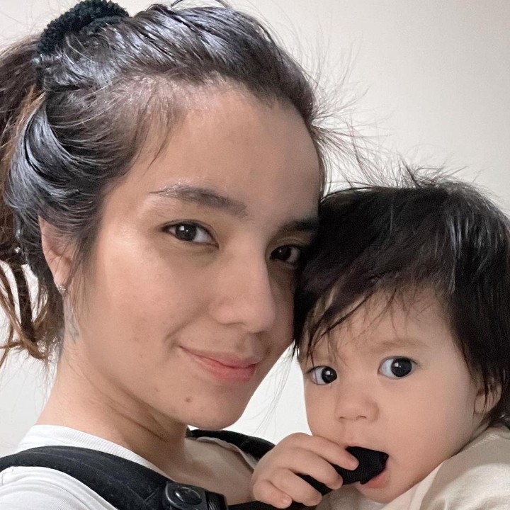 <p>Sheila menghapus tato dengan pengawasan dokter dan dilakukan dengan persiapan yang matang. (Foto: Instagram @itssheilamj)</p>