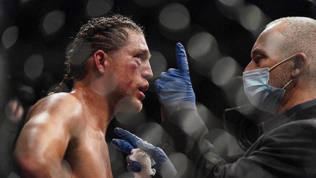 Yair Rodriguez meraih kemenangan singkat dengan TKO setelah bahu Brian Ortega copot dari engselnya dalam duel kelas bulu di UFC Long Island.