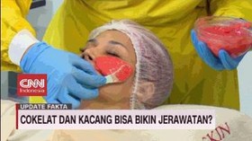 VIDEO: Fakta Mitos Jerawat dan Makanan