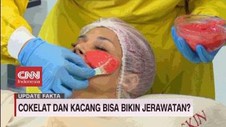 VIDEO: Fakta Mitos Jerawat dan Makanan