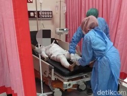 Istri di Probolinggo yang Dibakar Suami Sedang Hamil Muda