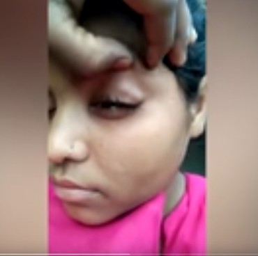 Gadis Asal India Keluarkan Batu Kecil Misterius dari Matanya Saat Menangis