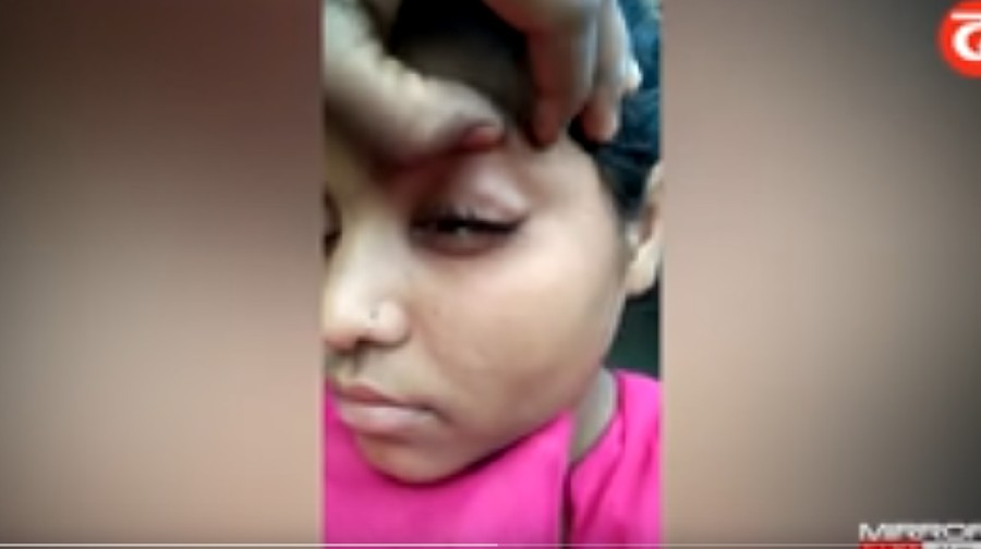 Viral
