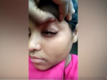Gadis Asal India Keluarkan Batu Kecil Misterius dari Matanya Saat Menangis